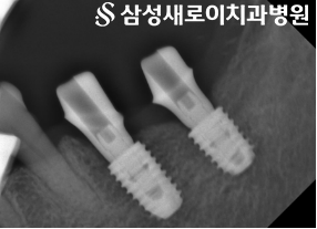 16020f67aceeb524b54aa3f50add1d9e_1792114490_0538.png