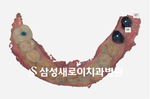 16020f67aceeb524b54aa3f50add1d9e_1792114511_7186.png